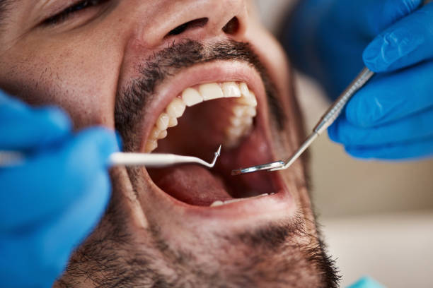 Best Oral Cancer Screening  in Hebron, IL